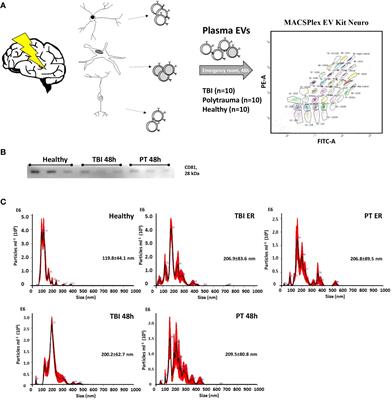 Identification of novel blood-based extracellular vesicles biomarker candidates with potential specificity for traumatic brain injury in polytrauma patients